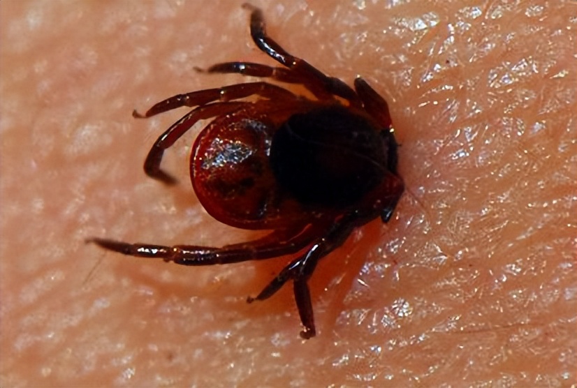 蜱虫的危害与预防_蜱虫叮咬处理方法_脾虫咬后的伤口图