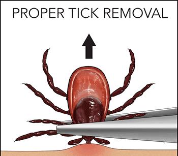 蜱虫叮咬处理方法_蜱虫的危害与预防_脾虫咬后的伤口图
