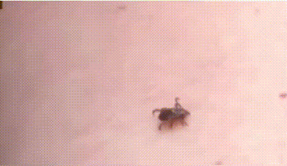 脾虫咬后的伤口图_蜱虫叮咬的危害与预防_被蜱虫咬伤的处理方法